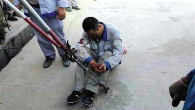 一名受伤的中国工人。